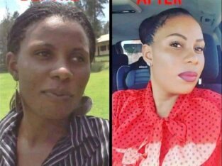 Skin Lightening Products In Ermelo+27 81 850 2816