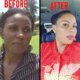 Skin Lightening Products In Ermelo+27 81 850 2816